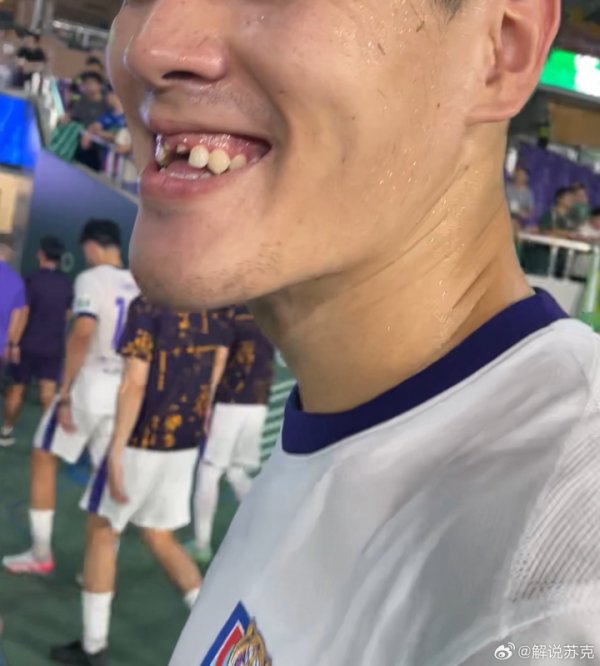 😨太惨了！津门虎0-2不敌浙江，中卫王献钧门牙在比赛中被撞掉